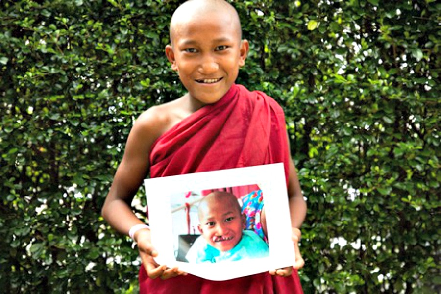Alliance for Smiles offers children and families with cleft anomalies hope for a bright future. we interviewed Alison Healy, CEO, to find out more.