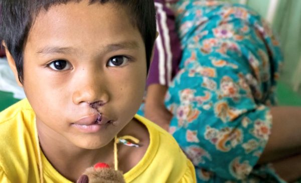 Alliance for Smiles offers children and families with cleft anomalies hope for a bright future. we interviewed Alison Healy, CEO, to find out more.